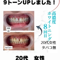 画像921