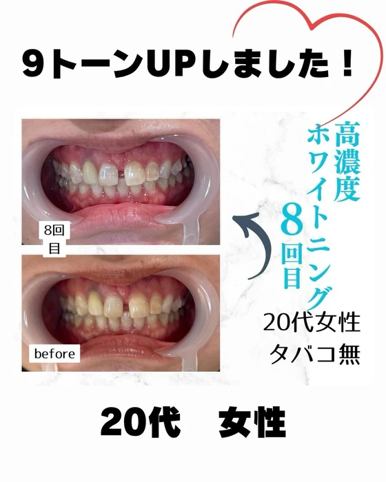 画像921