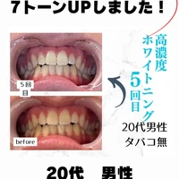 画像927