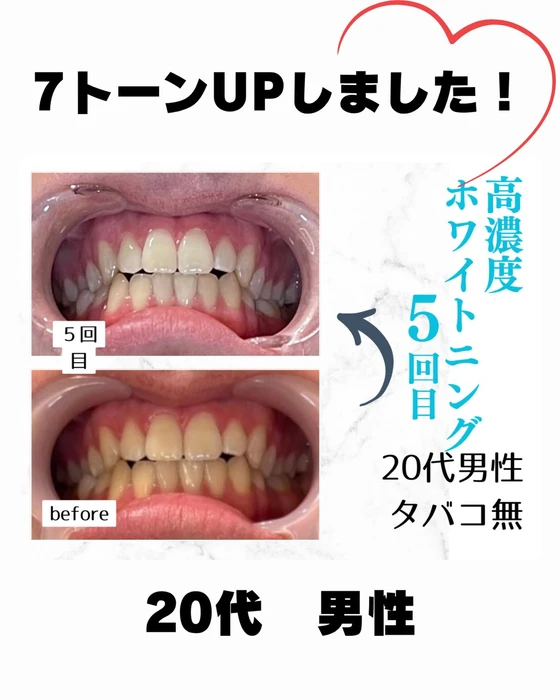 画像927