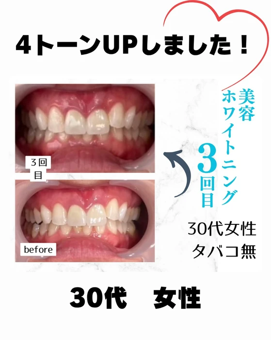 画像966