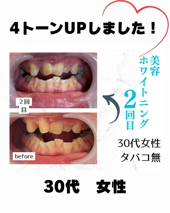 画像972