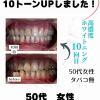 画像989