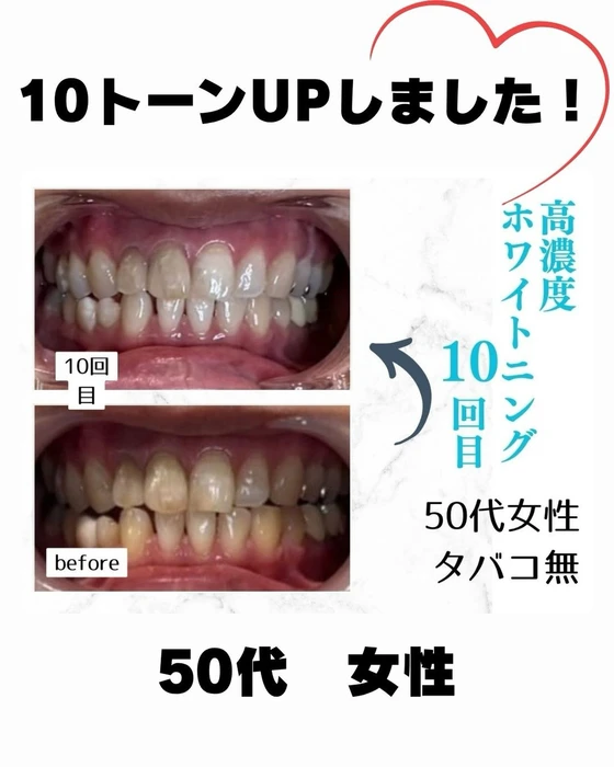 画像989
