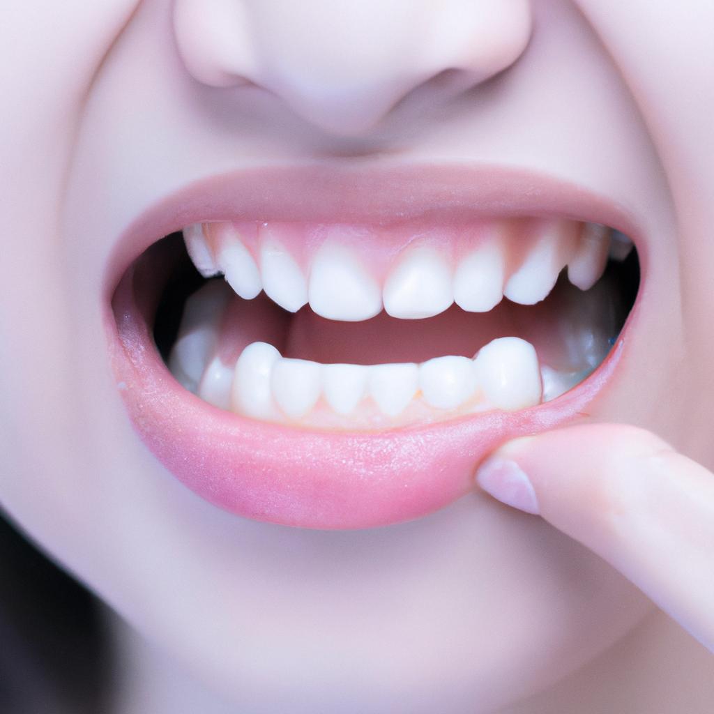 手軽に美白を実現！セルフホワイトニングで自信の笑顔を