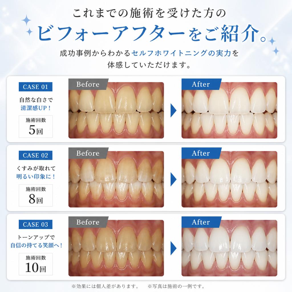 実際の施術例と効果