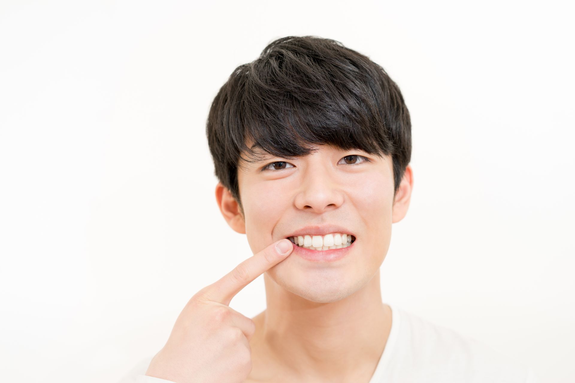 セルフホワイトニング